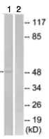 Антитела поликлональные кроличьи Anti-SLC16A3 antibody, 100 мкг, Abcam, ab74109