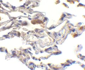 Антитела поликлональные кроличьи Anti-c-IAP1 и c-IAP2 antibody, 100 мкг, Abcam, ab25939