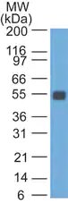 Антитела моноклональные мышиные Anti-EpCAM [GZ-1], 500 мкл, Abcam, ab187276