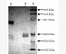 Антитела моноклональные мышиные Anti-TPA Tissue Plasminogen Activator, 200 мкг