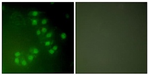 Антитела поликлональные кроличьи Anti-p63, 100 мкг, Abcam, ab53039