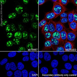 Антитела моноклональные кроличьи Anti-Ki67 antibody [SP6], 500 мкл, Abcam, ab16667