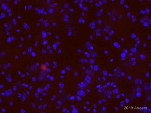 Антитела поликлональные кроличьи, Anti-Ovalbumin, 100 мкг, Abcam, ab181688