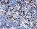 Антитела поликлональные кроличьи к человечьим, кроличьим и мышиным Anti-Ki67 antibody,100 мкг