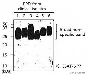 Антитела поликлональные кроличьи Anti-ESAT6, 100 мкг, Abcam, ab45073