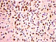 Антитела поликлональные кроличьи Anti-Olig2 antibody, 50 мкл