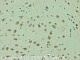 Антитела поликлональные кроличьи Anti-TRPM2, 50 мкг