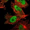 Антитела поликлональные кроличьи Anti-DNA Ligase III antibody, 100 мкл