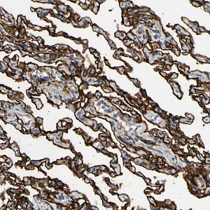 Антитела поликлональные кроличьи Anti-SUSD2 antibody, 100 мкл, Abcam, ab121214