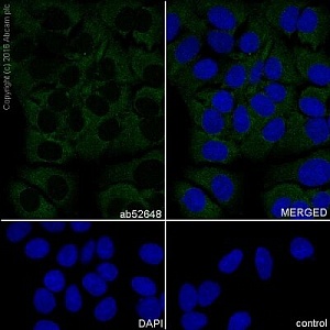 Антитела моноклональные кроличьи Anti-Flt3 ligand/Flt3L antibody [EP1140Y], 100 мкл, Abcam, ab52648