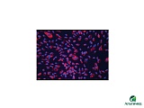 Клетки AoAF-Aortic Adven. Fibro SCGM, cryo amp, CC-7014