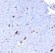 Антитела моноклональные мышиные Anti-EBV Latent Membrane Protein 1 antibody [CS1, CS2, CS3, CS4], prediluted, 6 мл