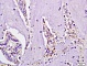 Антитела поликлональные кроличьи Anti-IL4R antibody, 100 мкл