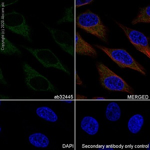Антитела моноклональные кроличьи Anti-Bad antibody [Y208], 100 мкл, Abcam, ab32445