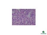 Клеточная линия 5637, Human Urinary bladder carcinoma cell line, 2.5 млн кл/мл, 1.5 мл