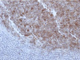 Антитела к CD10, клон GM003