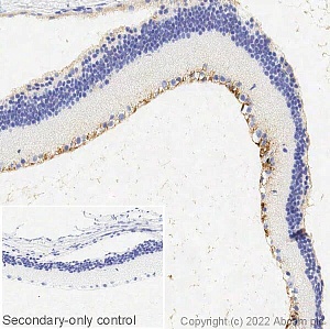 Антитела моноклональные мышиные Anti-CRALBP [B2], 100 мкг, Abcam, ab15051