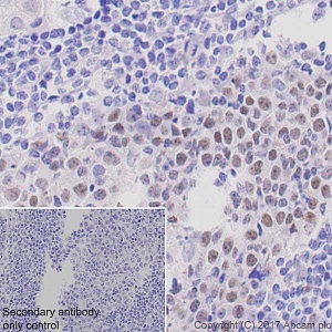 Антитела моноклональные кроличьи Recombinant Anti-bcl-6 [EPR11410-43], 100 мкл, Abcam, ab172610
