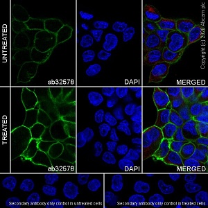 Антитела моноклональные кроличьи Anti-EGFR (phospho Y1173) antibody [E124], 100 мкл, Abcam, ab32578