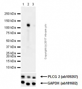 Антитела моноклональные кроличьи Anti-PLCG 2 (phospho Y1217 + Y1217), 100 мкл, Abcam, ab52610