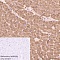 Моноклональные кроличьи антитела Anti-Cardiac Troponin I antibody [EP1106Y], 100 мкл