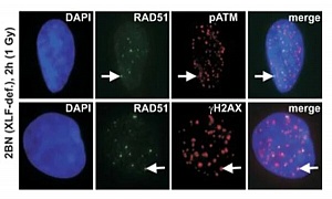 Антитела кроличьи поликлональные Anti-Rad51 antibody, 100 мкл, Abcam, ab63801