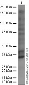 Антитела моноклональные мышиные Anti-Phosphotyrosine antibody [PY20] (HRP), 100 мкл, Abcam, ab16389