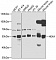 Антитела поликлональные кроличьи Anti-HEXA antibody - C-terminal, 100 мкл