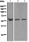 Антитела моноклональные кроличьи [EPR5371] к антитромбину III / ATIII, 100 мкл