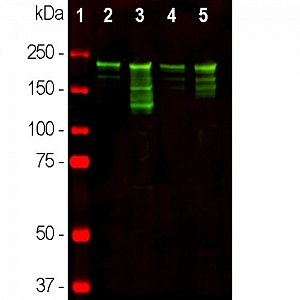 Антитела кроличьи поликлональные Anti-Neurofilament heavy polypeptide, 50 мкл, Abcam, ab8135