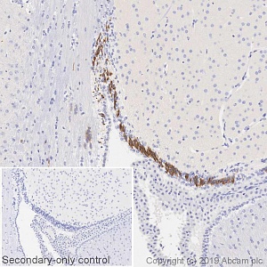 Антитела поликлональные кроличьи к даблкортину, 50 мкг, Abcam, ab18723